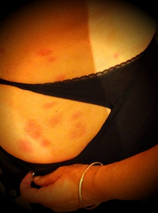 Don’t let the bed bugs bite! Don’t let the bed bugs bite!